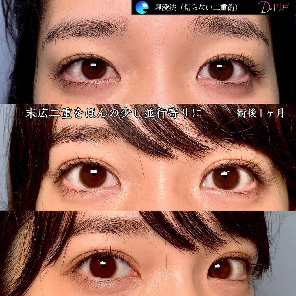 円戸統括院長が行った症例写真