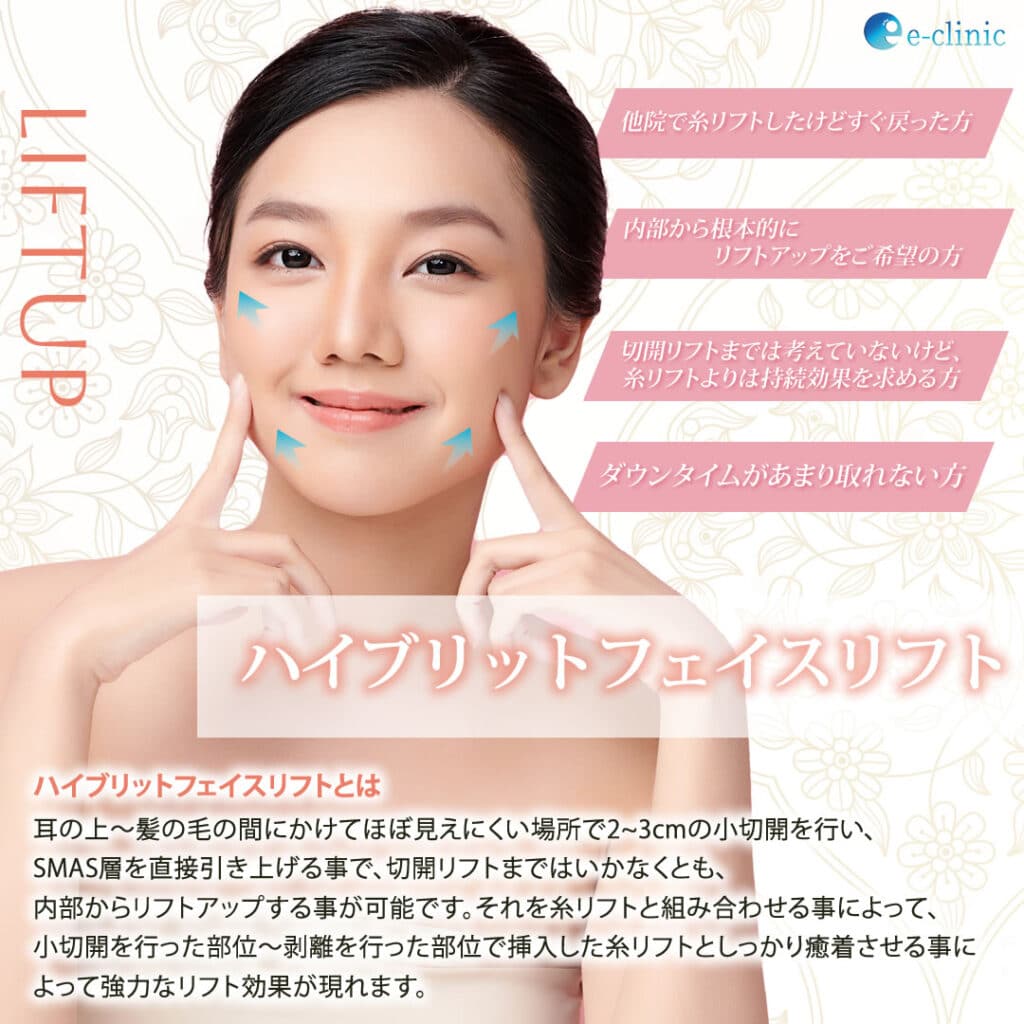 ハイブリッド フェイスリフトのバナー