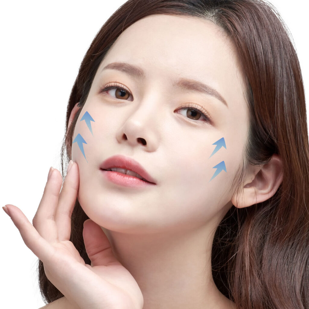 ウルトラフォーマーを受けた女性のイメージ