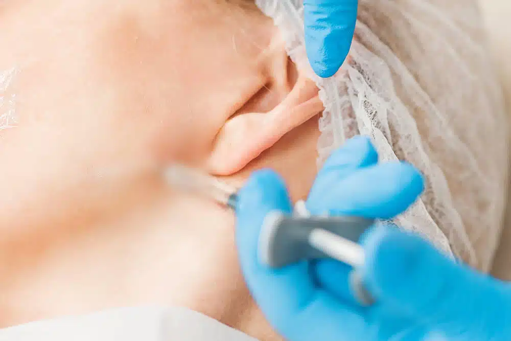 ボトックス(エラ・唾液腺)