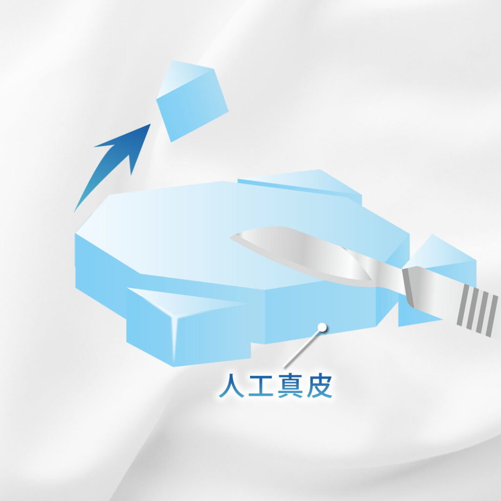 人工真皮を切っているところ