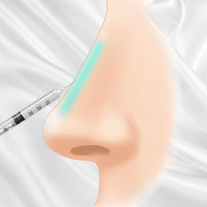 鼻のヒアルロン酸のイメージ