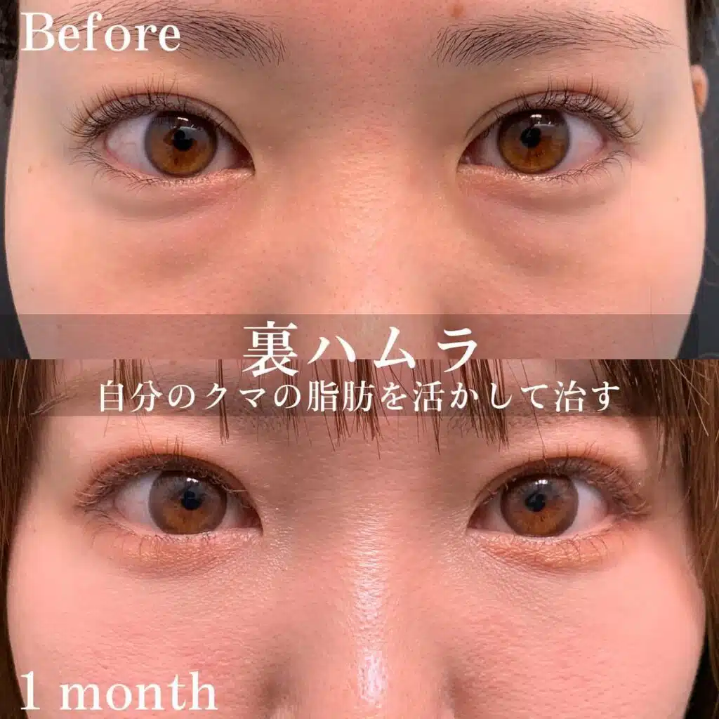 裏ハムラ　富山駅前