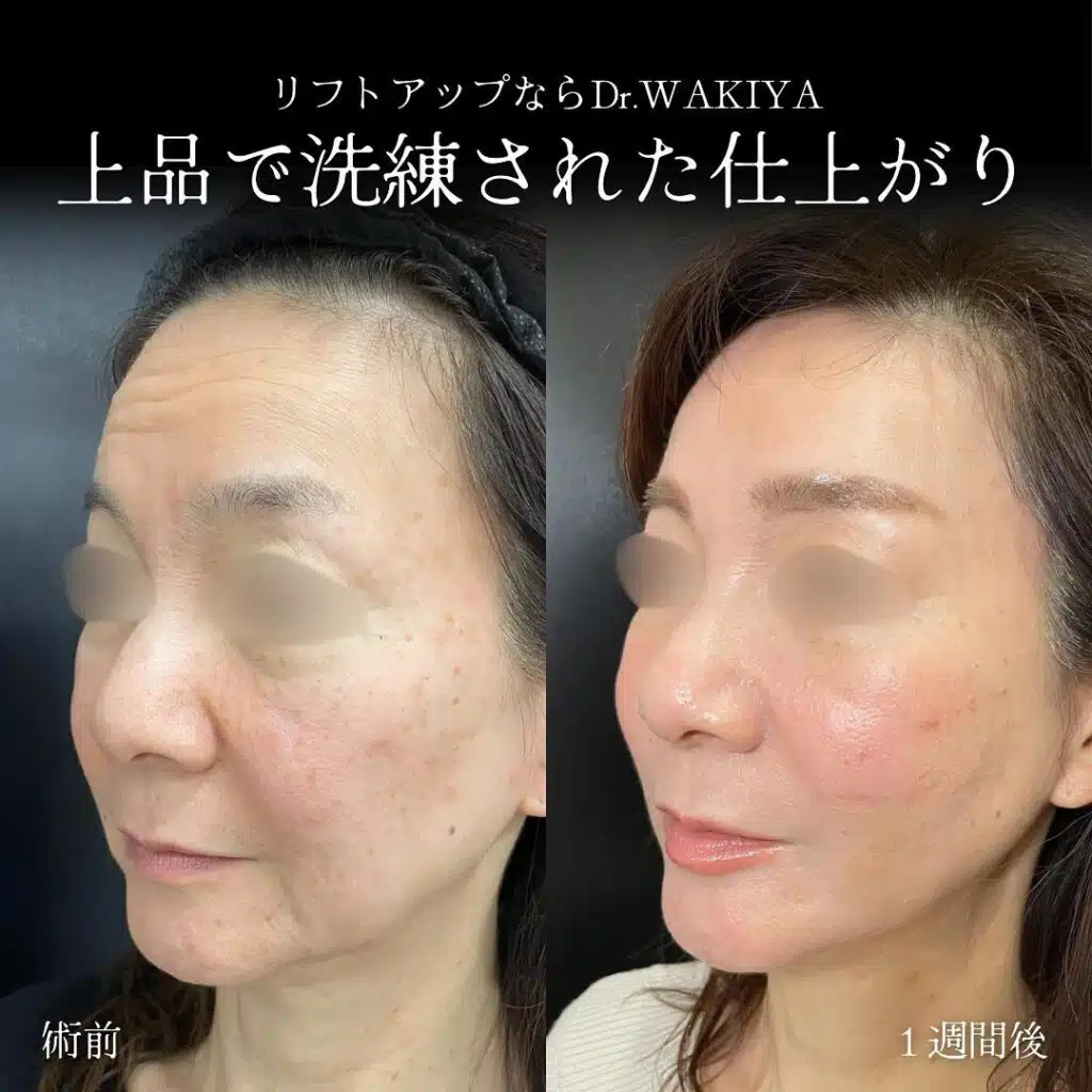 上品で洗練された仕上がり 富山駅前