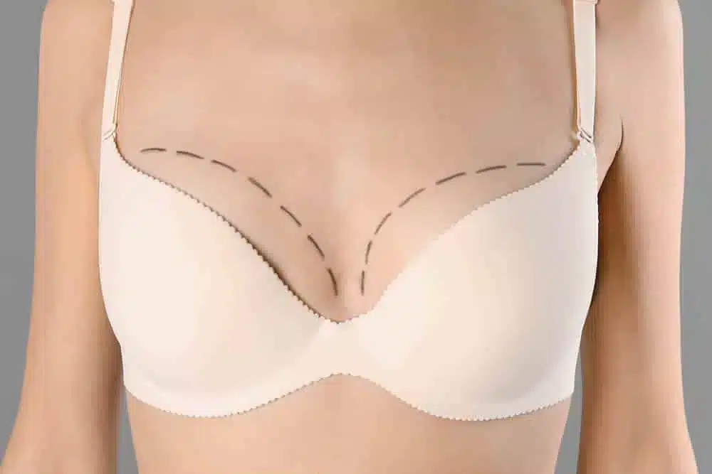 ヒアルロン酸豊胸　富山駅前