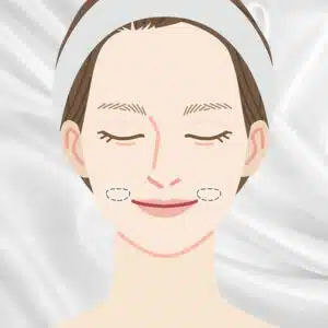 ジョールファット除去　富山駅前