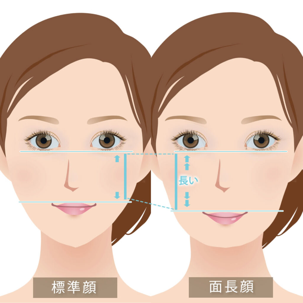 標準顔と面長顔の長い部分の図解