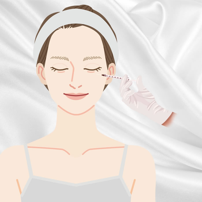 涙袋ヒアルロン酸のイメージ