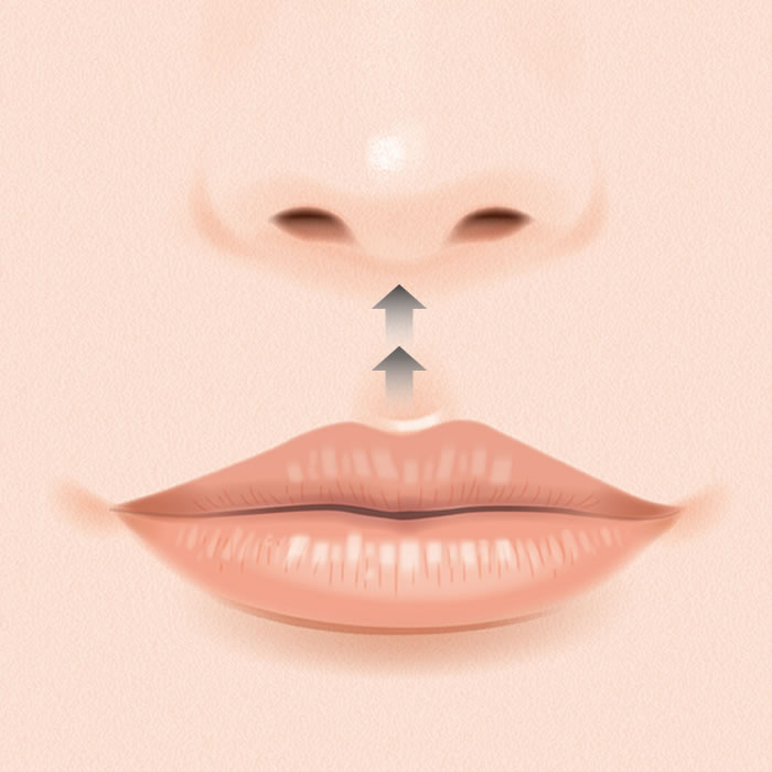 人中短縮のイメージ