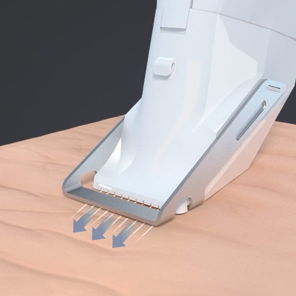 ブレッシングの針が刺さっている分かり易い図解