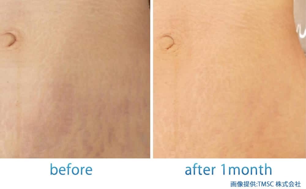 リジェネラの症例写真 (3)