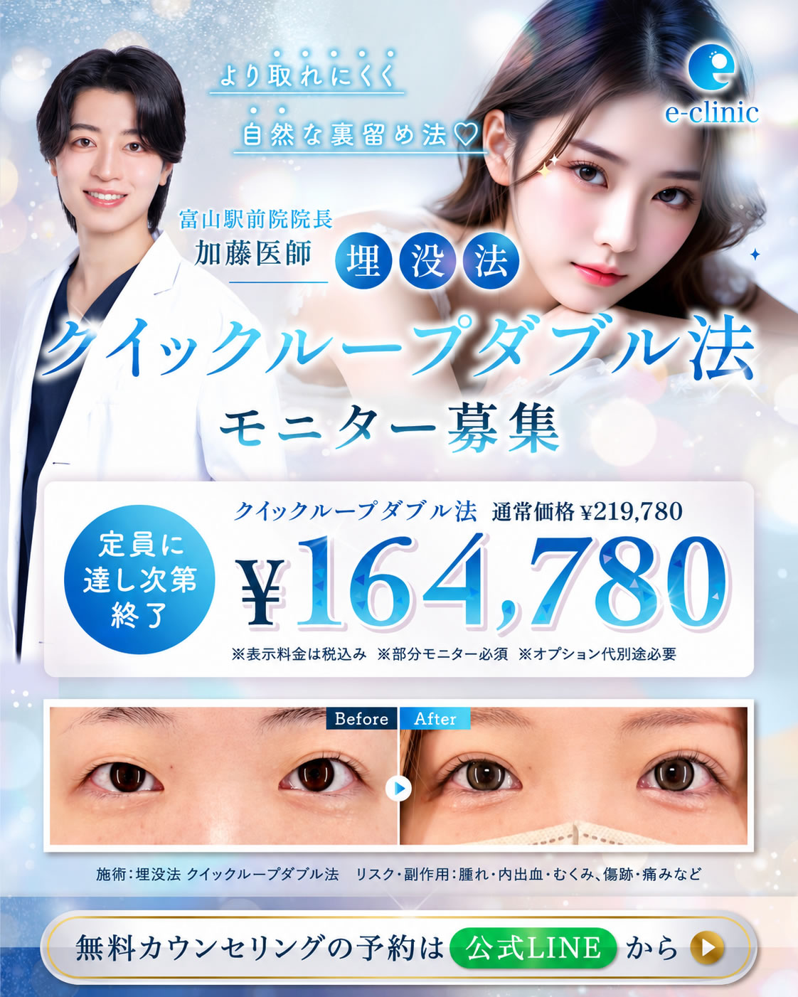 加藤快世医師のクイックループダブルのバナー
