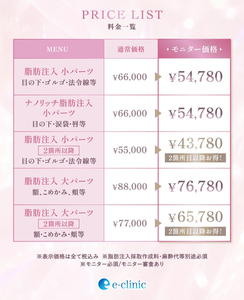 顔の脂肪吸引のキャンペーン料金表
