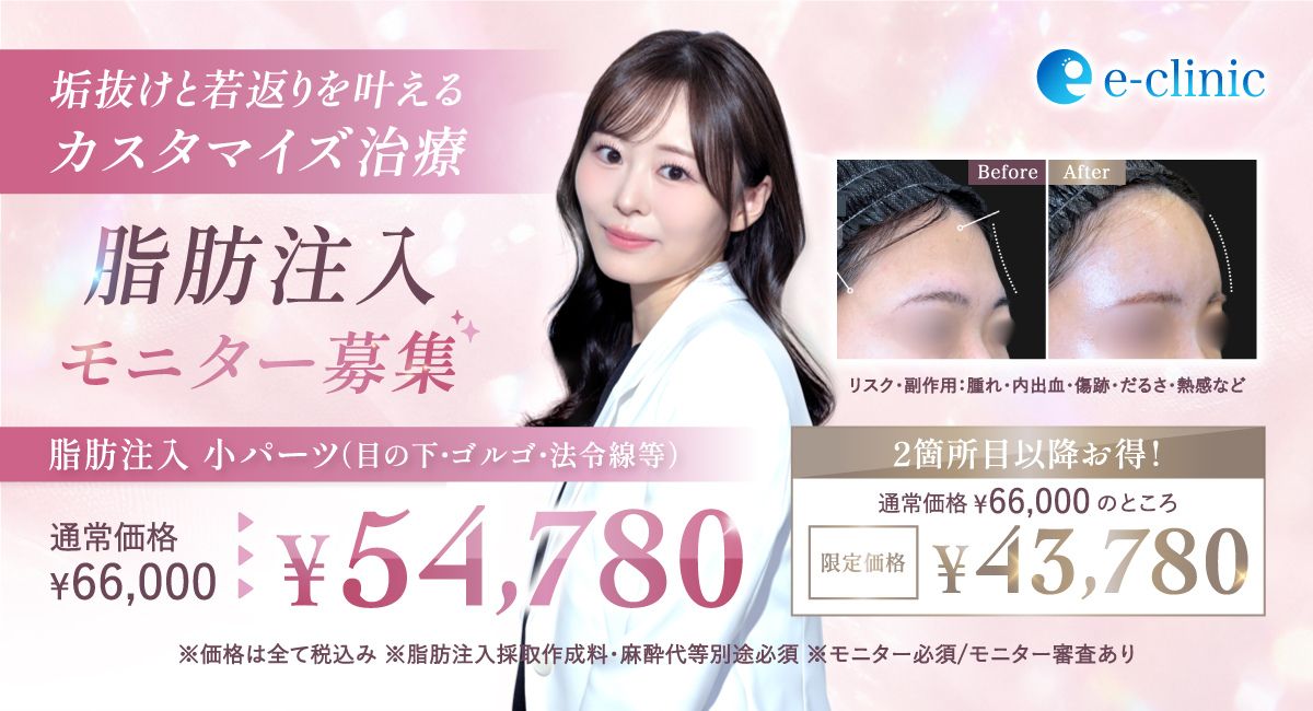 上坂 こころ医師の顔の脂肪注入のキャンペーンバナー
