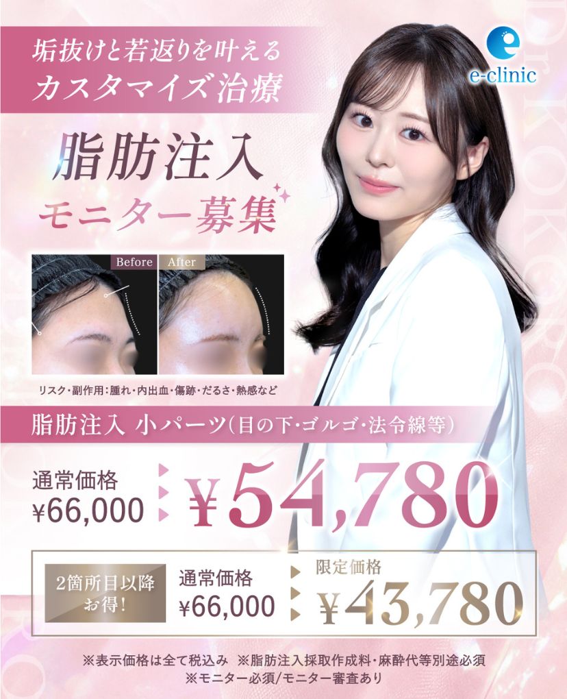 上坂 こころ医師の顔の脂肪吸引のキャンペーンバナー